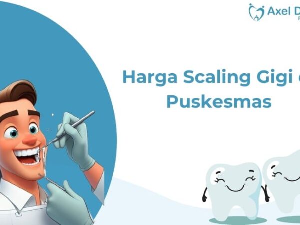 Biaya Scaling Gigi di Puskesmas: Panduan Lengkap untuk Kesehatan Mulut Optimal