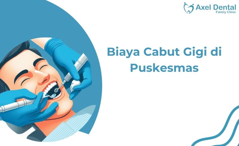 Cabut Gigi di Puskesmas: Mengupas Tuntas Biaya, Prosedur, dan Manfaatnya untuk Kesehatan Anda