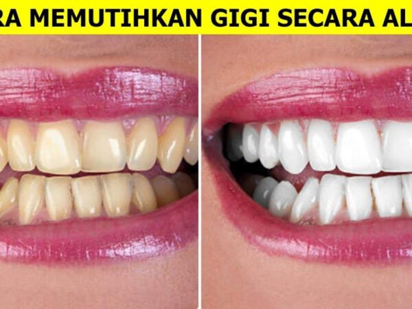 Rahasia Gigi Putih Alami: Metode Aman dan Efektif untuk Senyum Lebih Cerah
