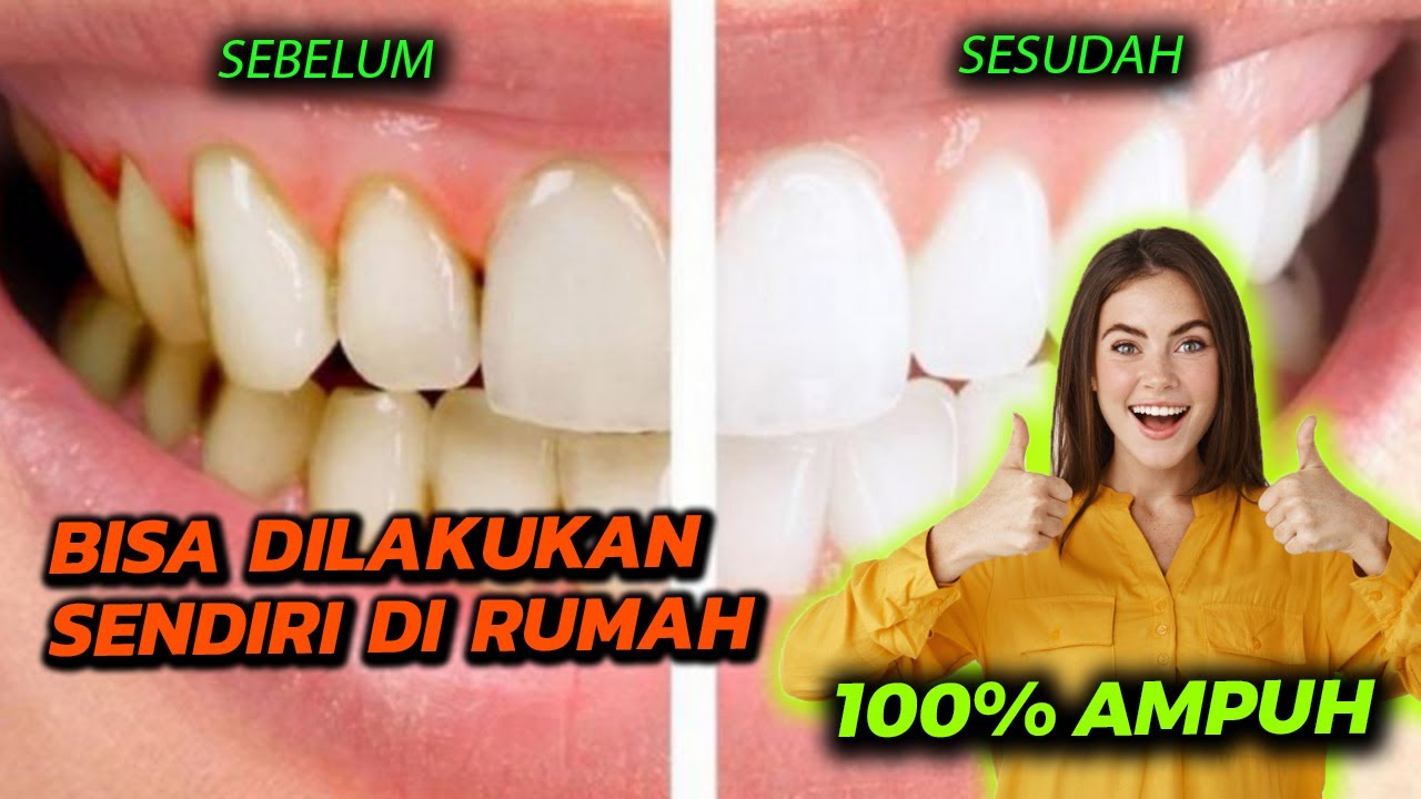 Senyum Bebas Karang Gigi: Panduan Mendalam Membersihkan dan Mencegahnya di Rumah